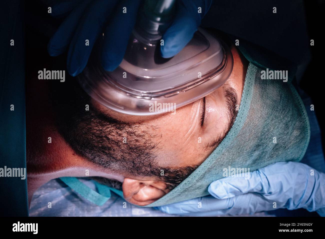 Close-up view of a patient receiving anesthesia in a surgical setting ...