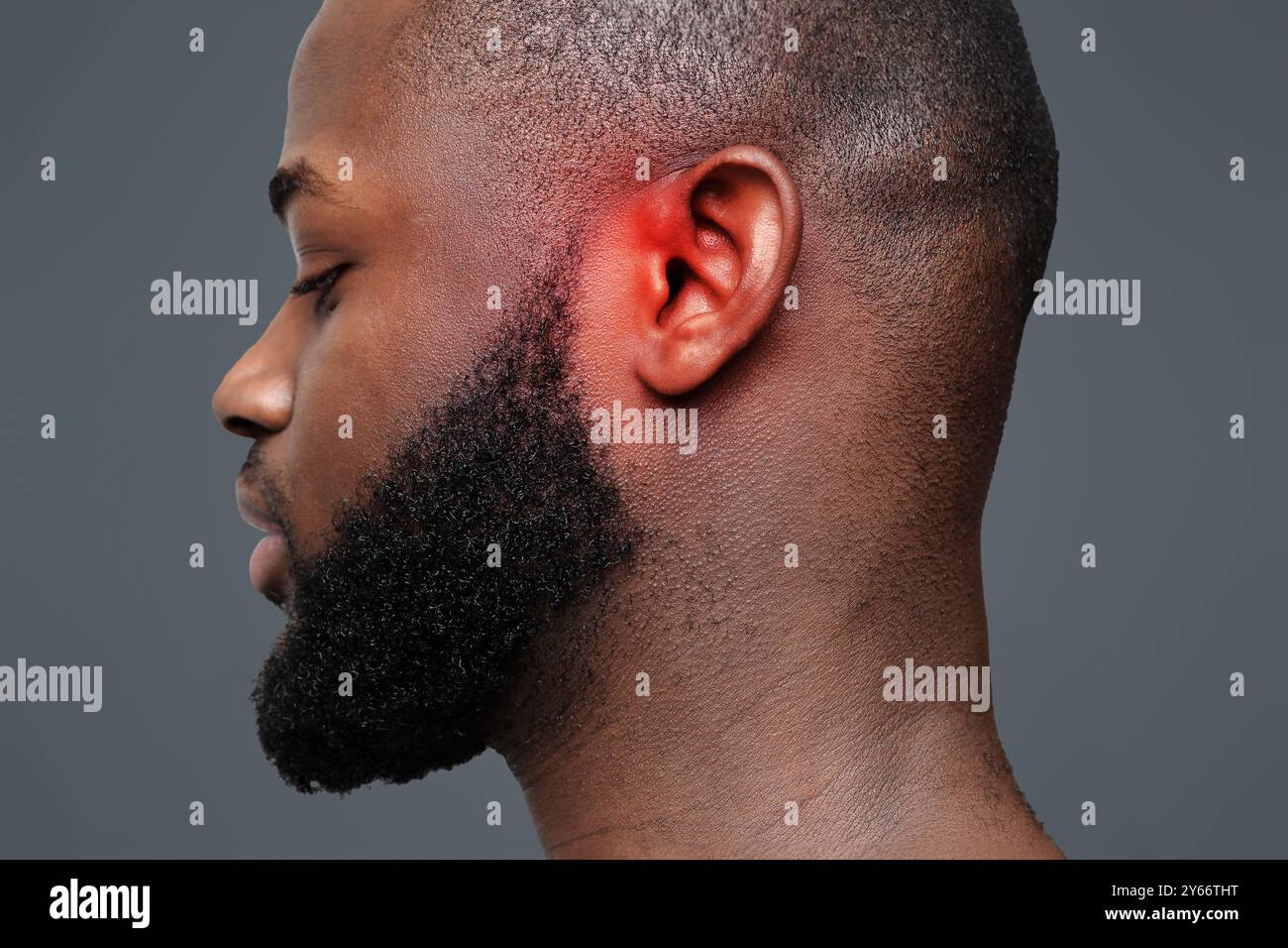 Inflamed ear hi-res stock photography and images - Alamy