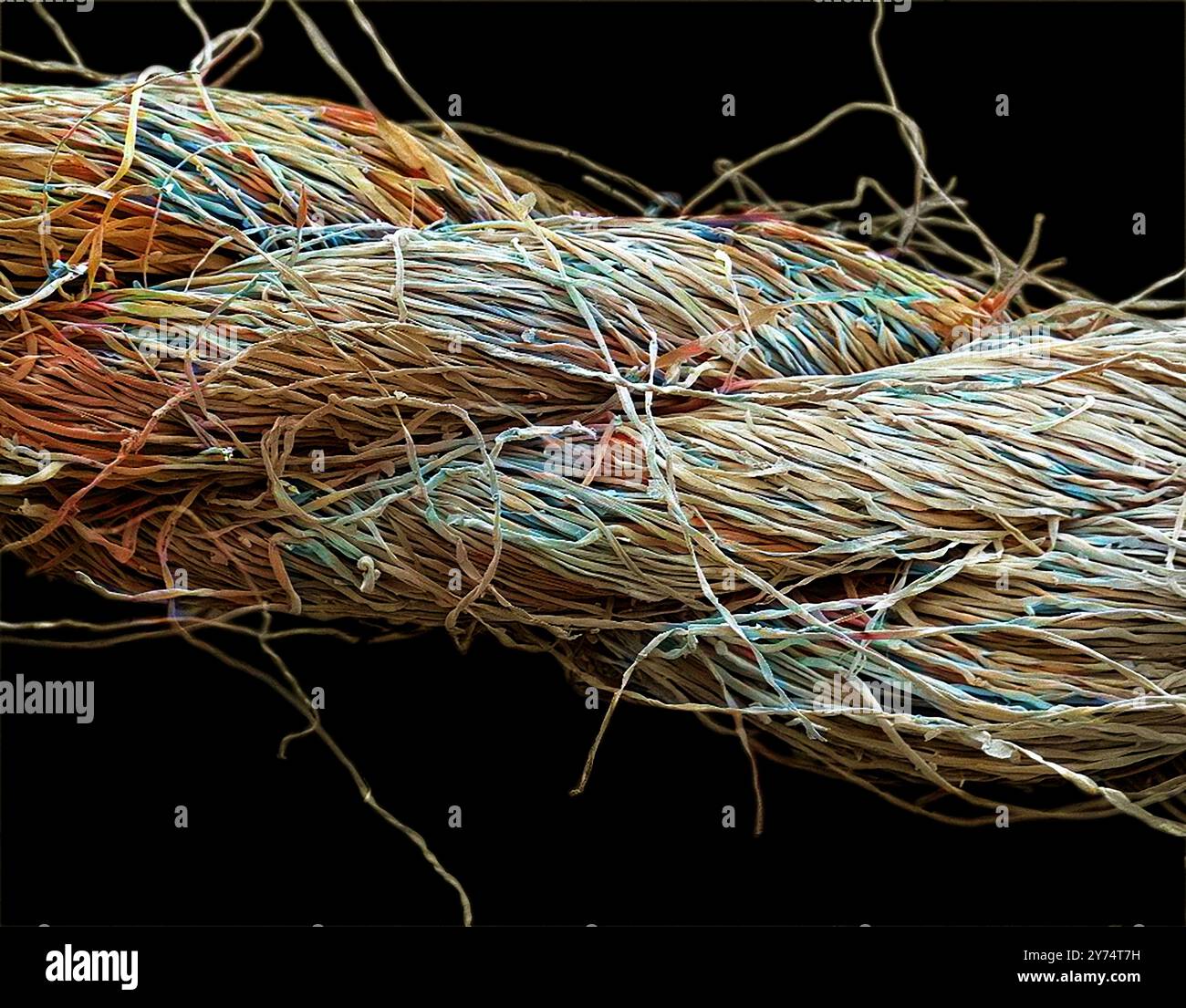 Viscose fibres from a tampon. Scanning electron micrograph of highly ...