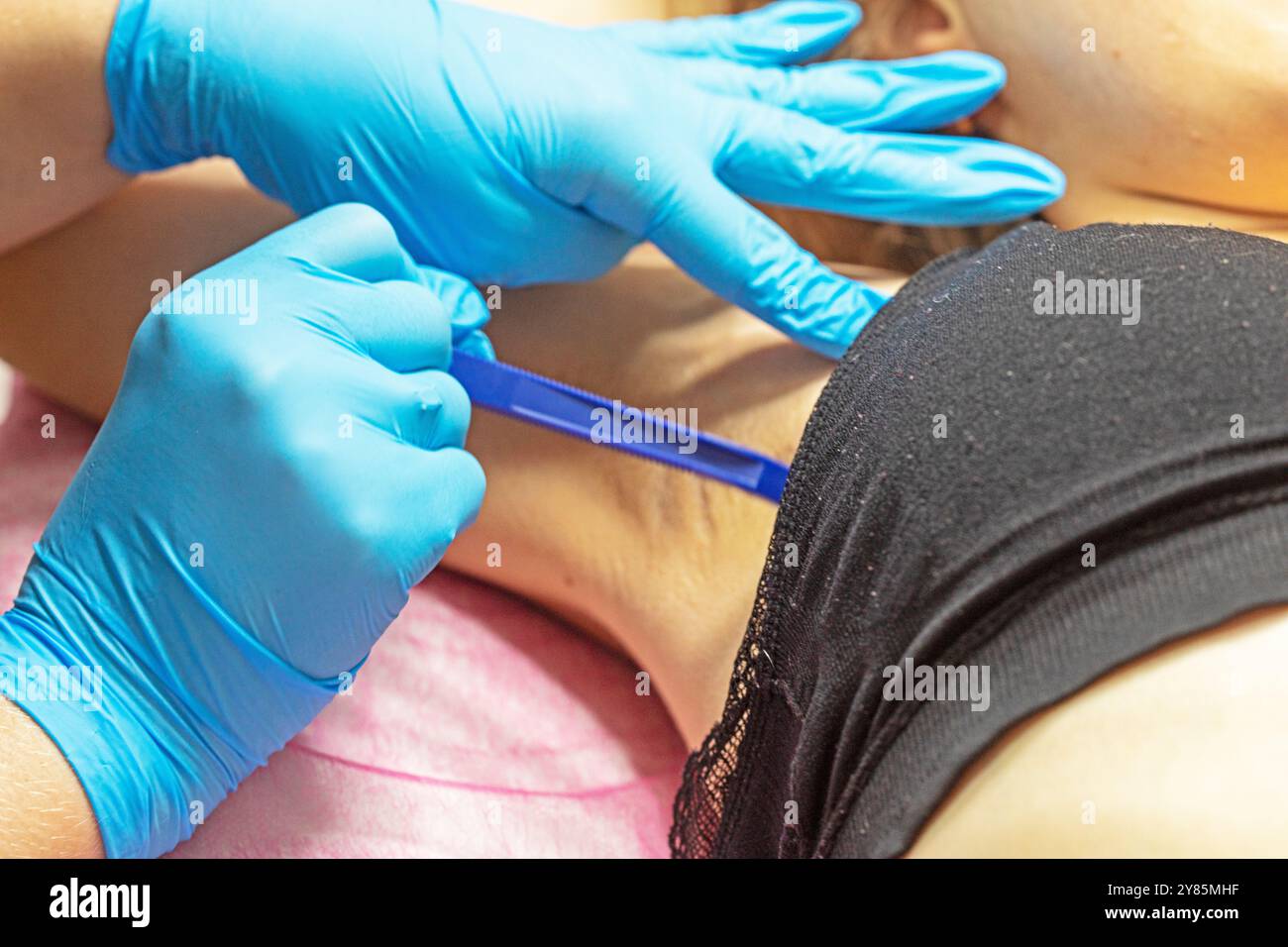 cosmetologist shaves off excess hair with a razor before laser hair ...
