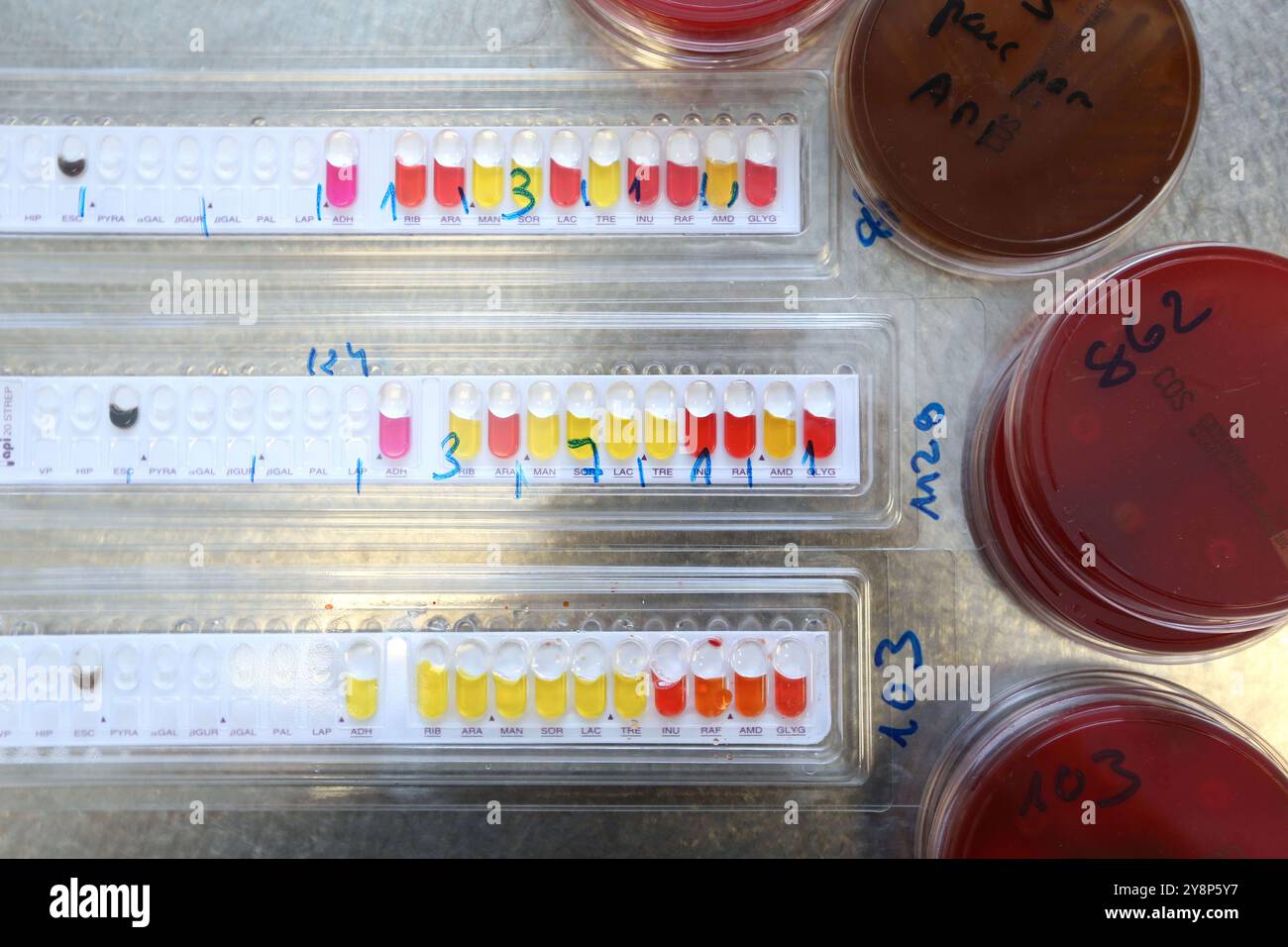 API Microbiology test, Identifying bacteria Laboratory technician ...