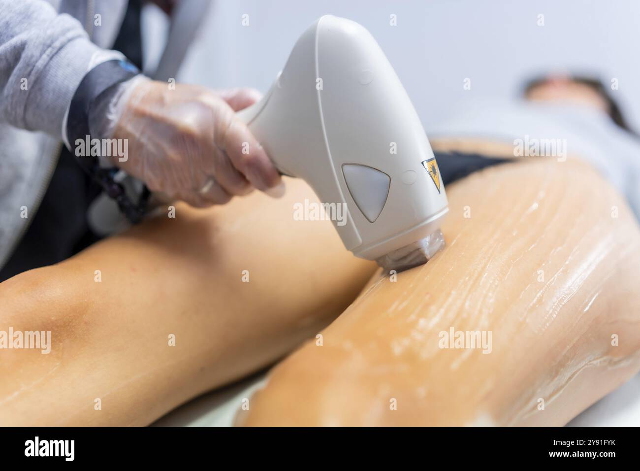 Close-up of caucasian female doctor holding cosmetology device while woman lying on bed is receiving calf leg hair removal procedure with laser machin Stock Photo
