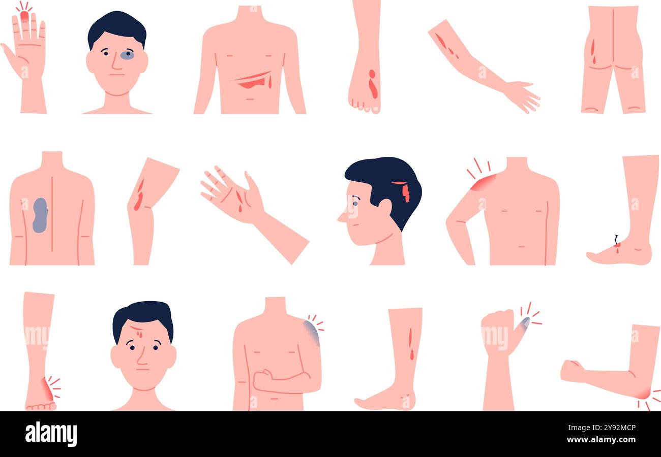 Physical injury. Human body parts with various wounds injury bruise ...