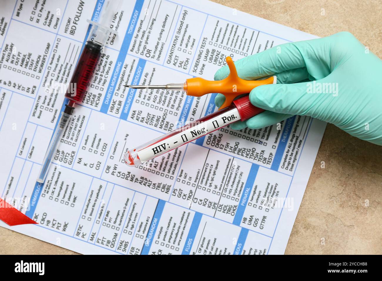 Doctor with HIV blood test tube and laboratory report form on beige grunge background Stock Photo