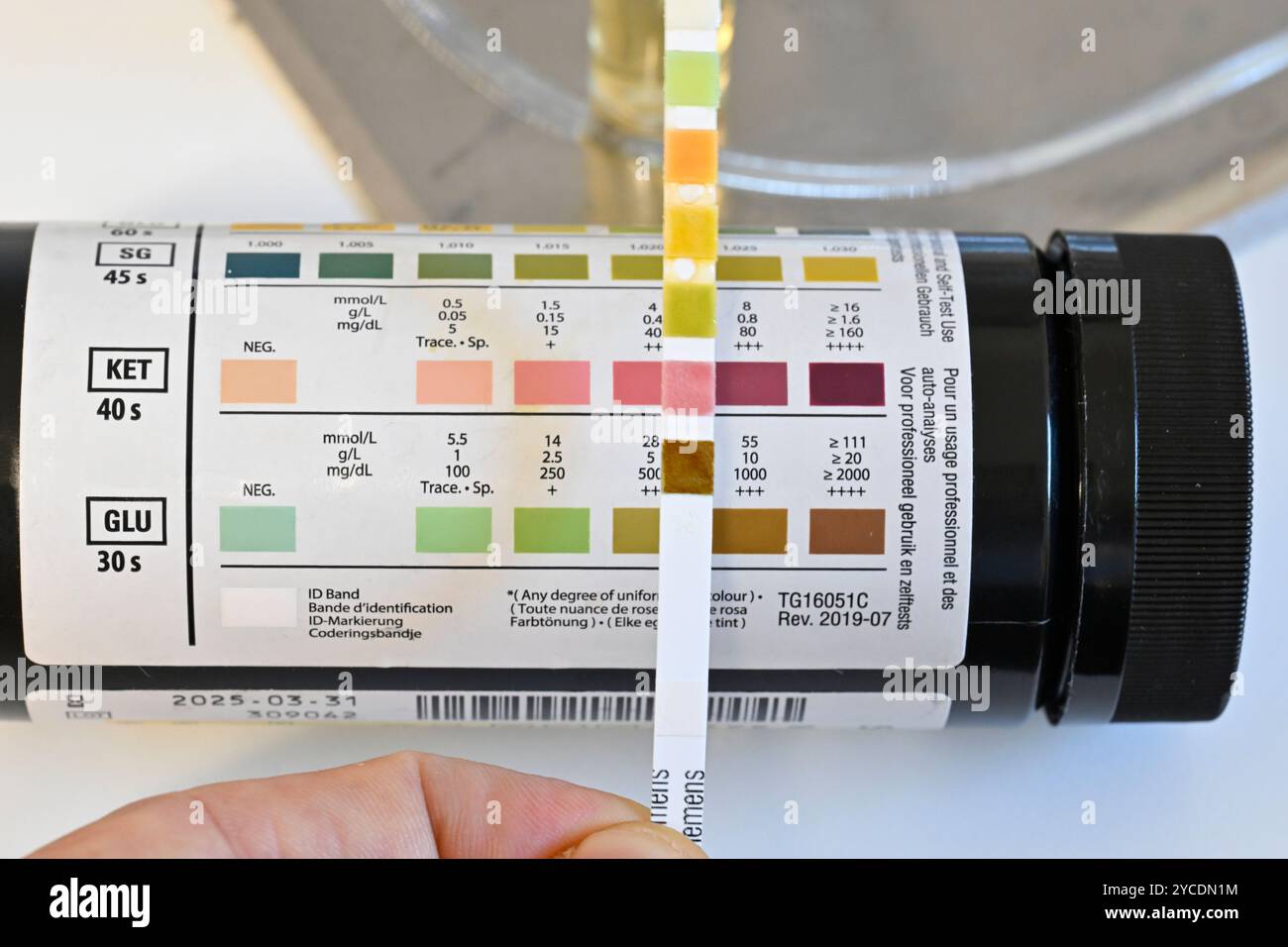 Glucose and ketone urine test strips. The dipstick is immersed in urine