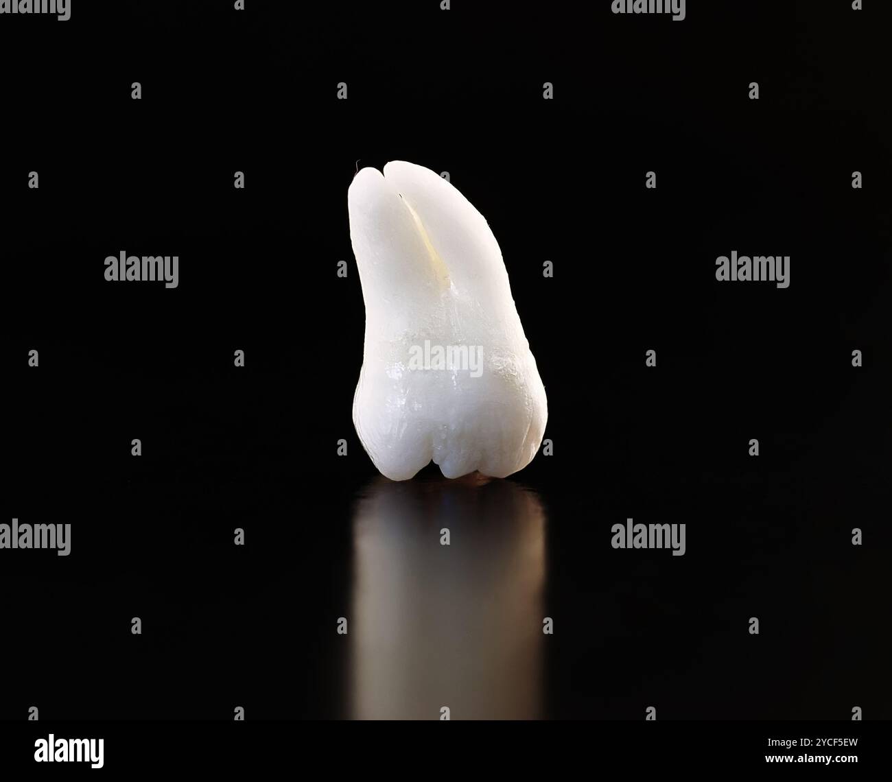 Tooth Image Real Real Human Wisdom tooth Stock Photo - Alamy