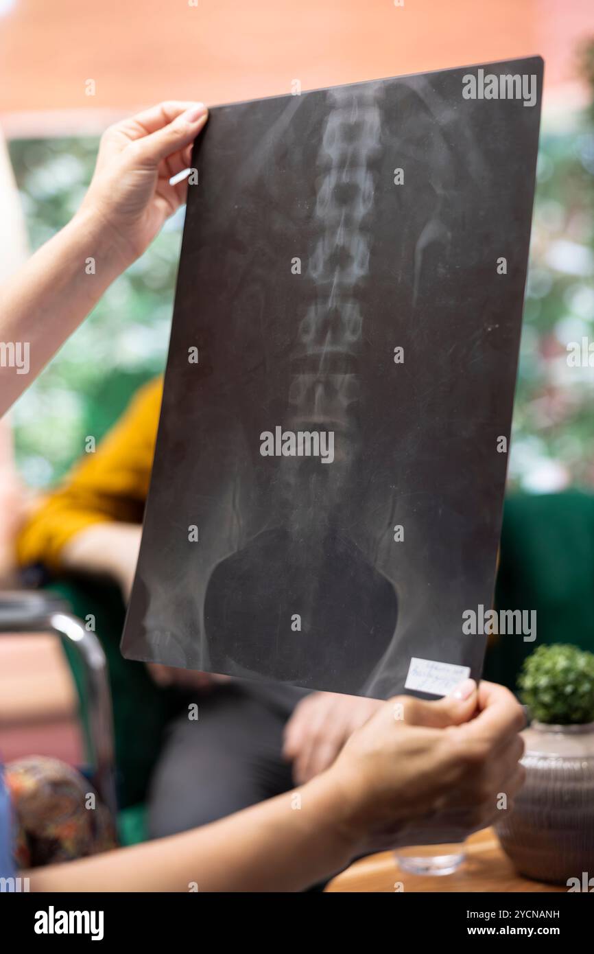 Medical caretaker presenting the x ray scan results and diagnosis ...