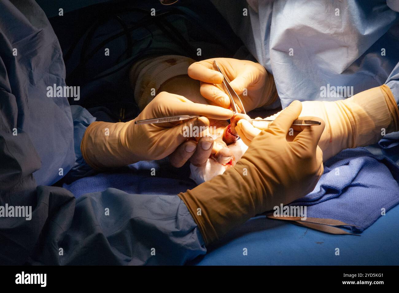 A surgical procedure in progress, with a surgeon and assistants working together to perform the operation. Stock Photo