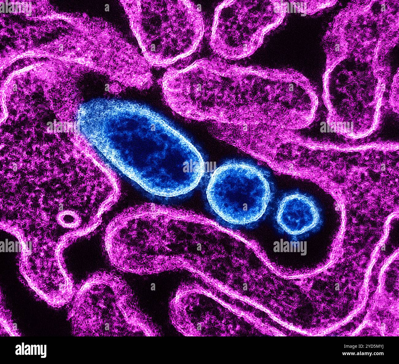Colorized transmission electron micrograph of mature extracellular ...