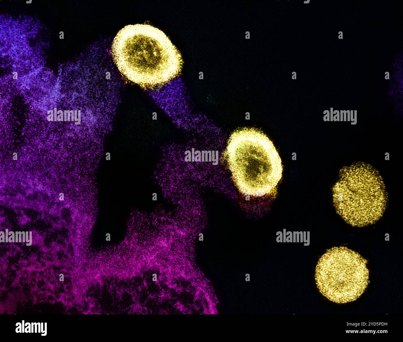Transmission electron micrograph of HIV-1 virus particles (yellow) replicating from the plasma membrane of an H9 T cell (purple and pink). Stock Photo
