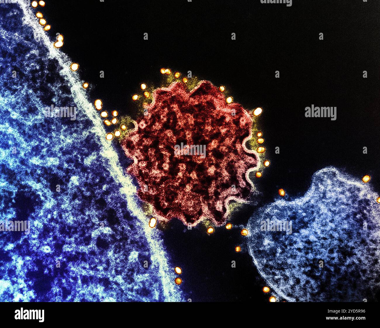 Colorized Transmission Electron Micrograph Of A Single Nipah Virus colorized-transmission-electron-micrograph-of-a-single-nipah-virus