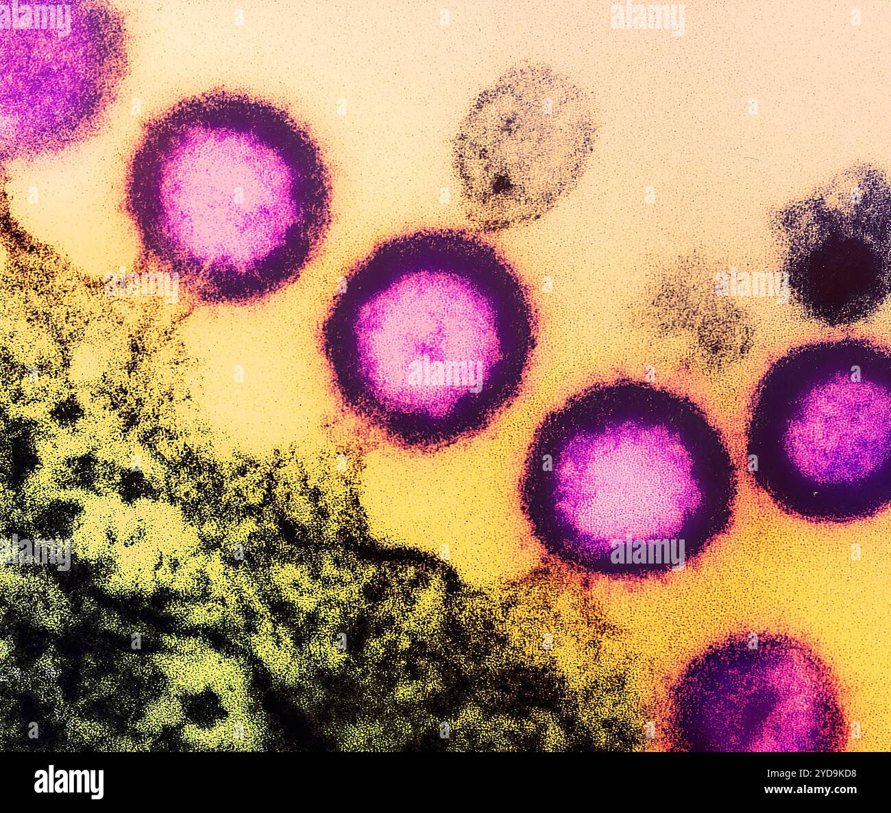 Transmission electron micrograph of HIV-1 virus particles pink replicating from the plasma membrane of an infected H9 T cell. HIV-1 Virus 016867 218 Stock Photo