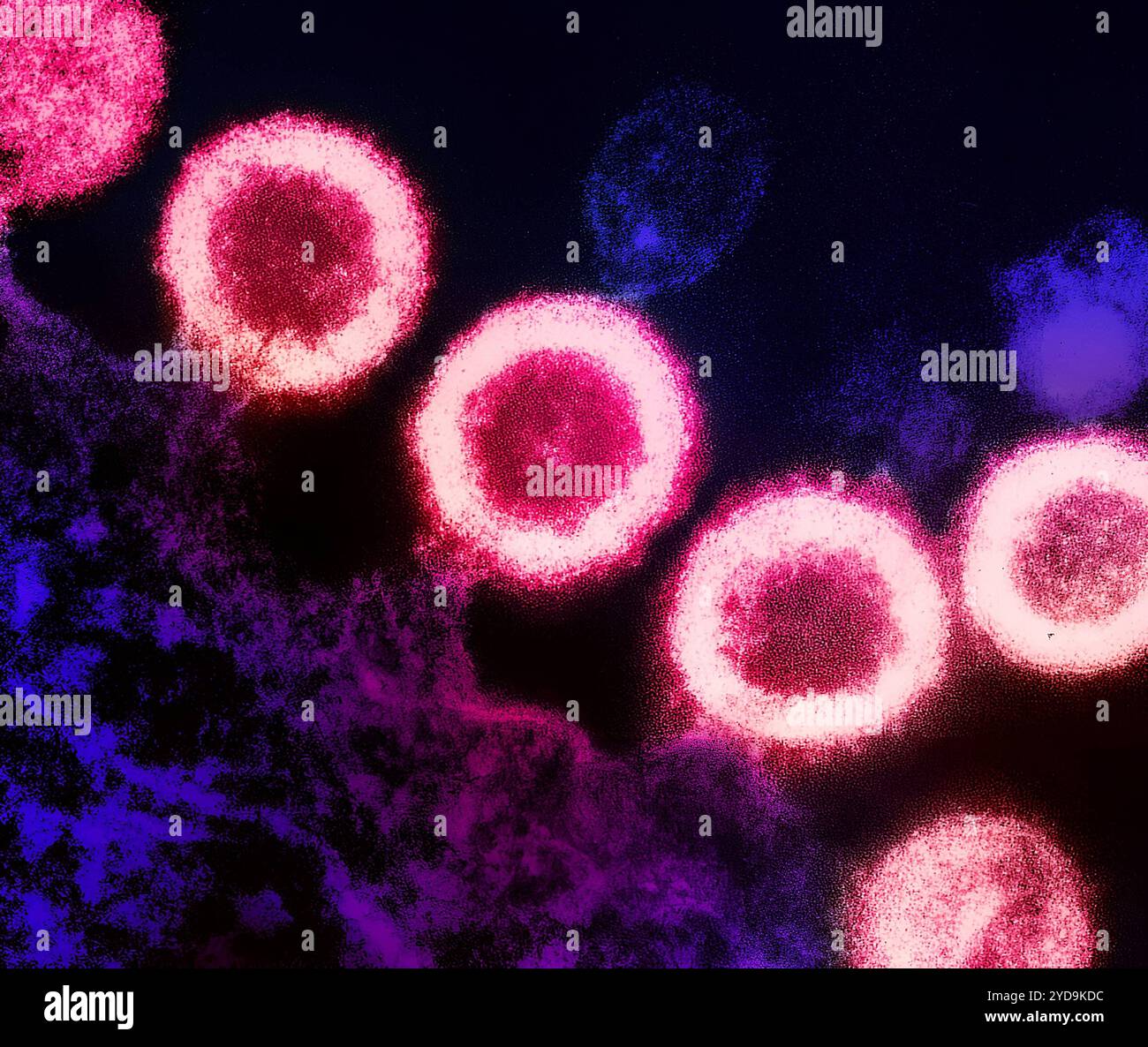 Transmission electron micrograph of HIV-1 virus particles pink replicating from the plasma membrane of an infected H9 T cell purple. HIV-1 Virus 016867 217 Stock Photo