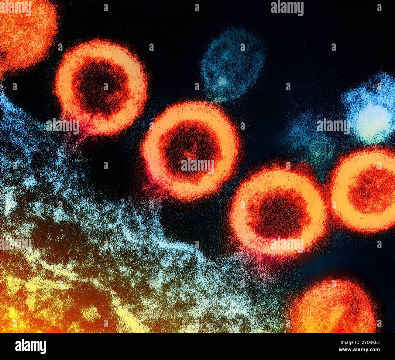 Transmission electron micrograph of HIV-1 virus particles orange replicating from the plasma membrane of an infected H9 T cell. HIV-1 Virus 016867 216 Stock Photo