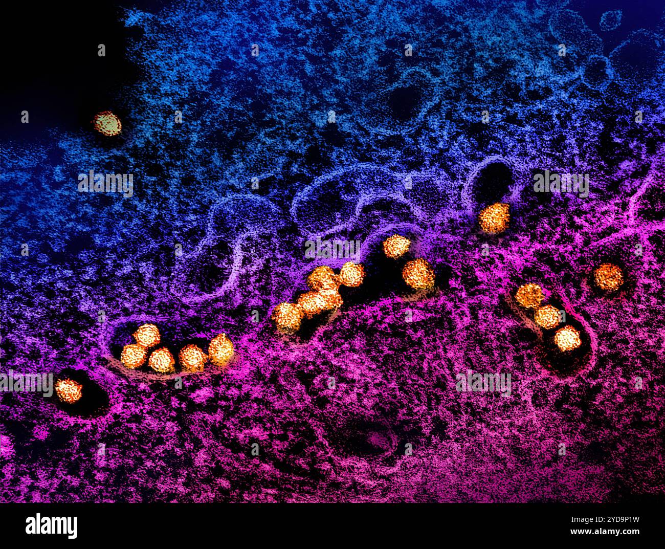 Transmission electron micrograph of West Nile virus particles gold replicating within the cytoplasm of an infected VERO E6 cell pink/purple/blue. West Nile Virus 016867 046 Stock Photo