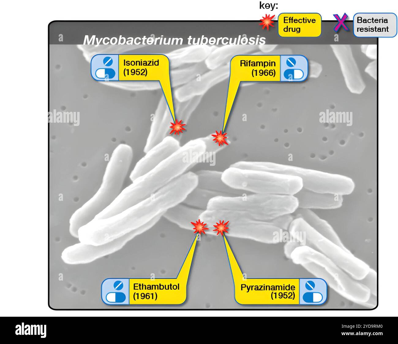 tuberculosis-which-results-from-an-infection-with-mycobacterium