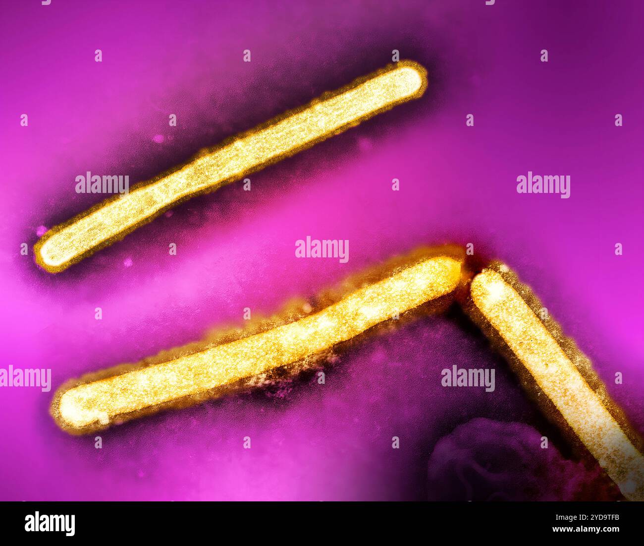 Transmission electron micrographs hi-res stock photography