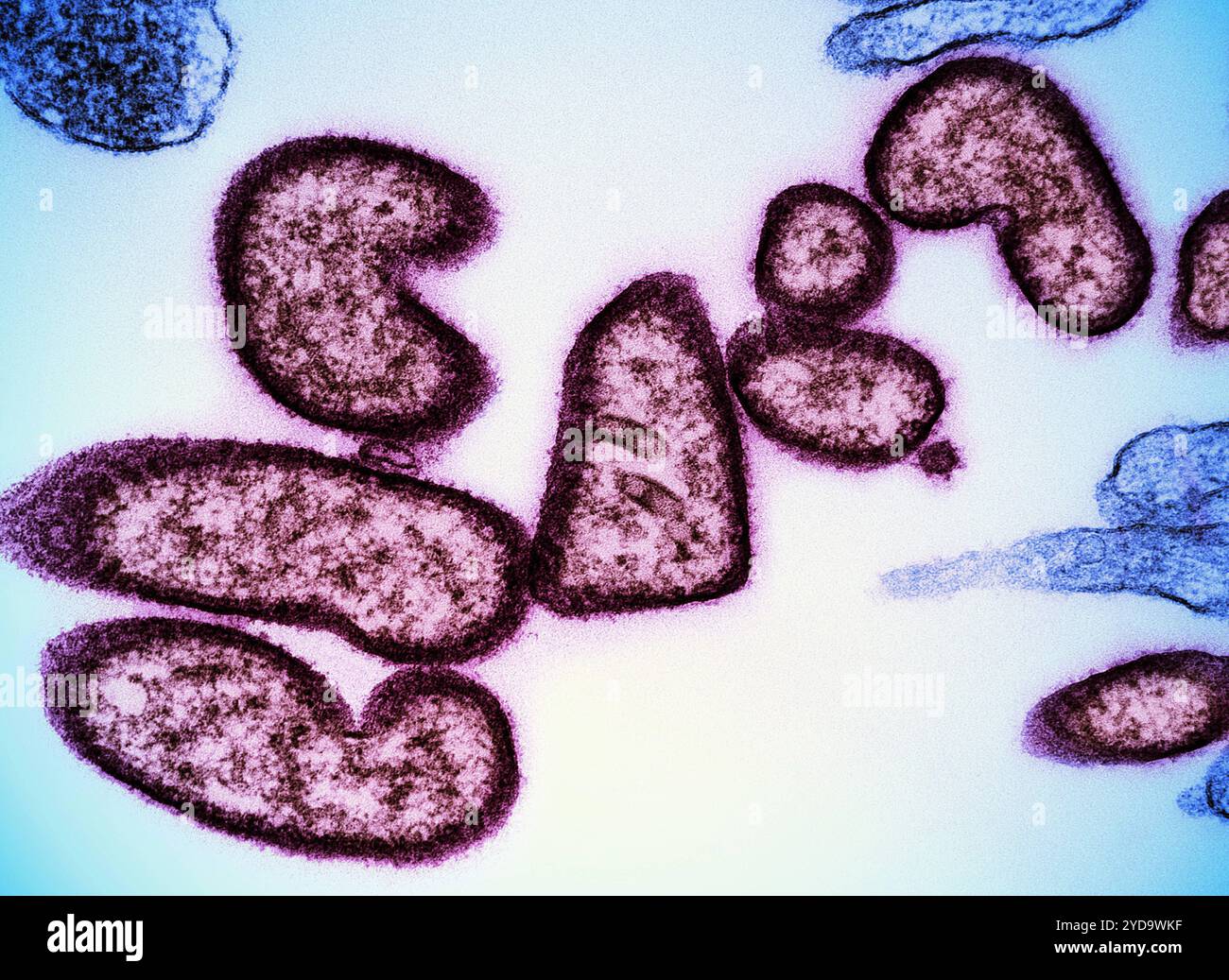 Nipah virus infektion hi-res stock photography and images - Alamy