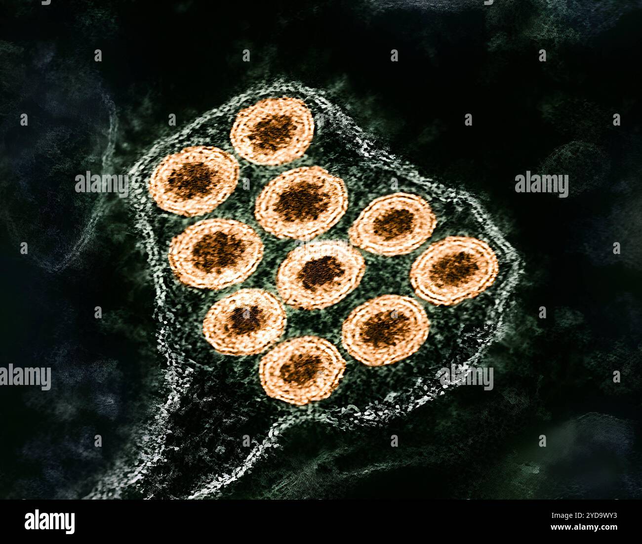 Colorized transmission electron micrograph of rabies virus particles ...
