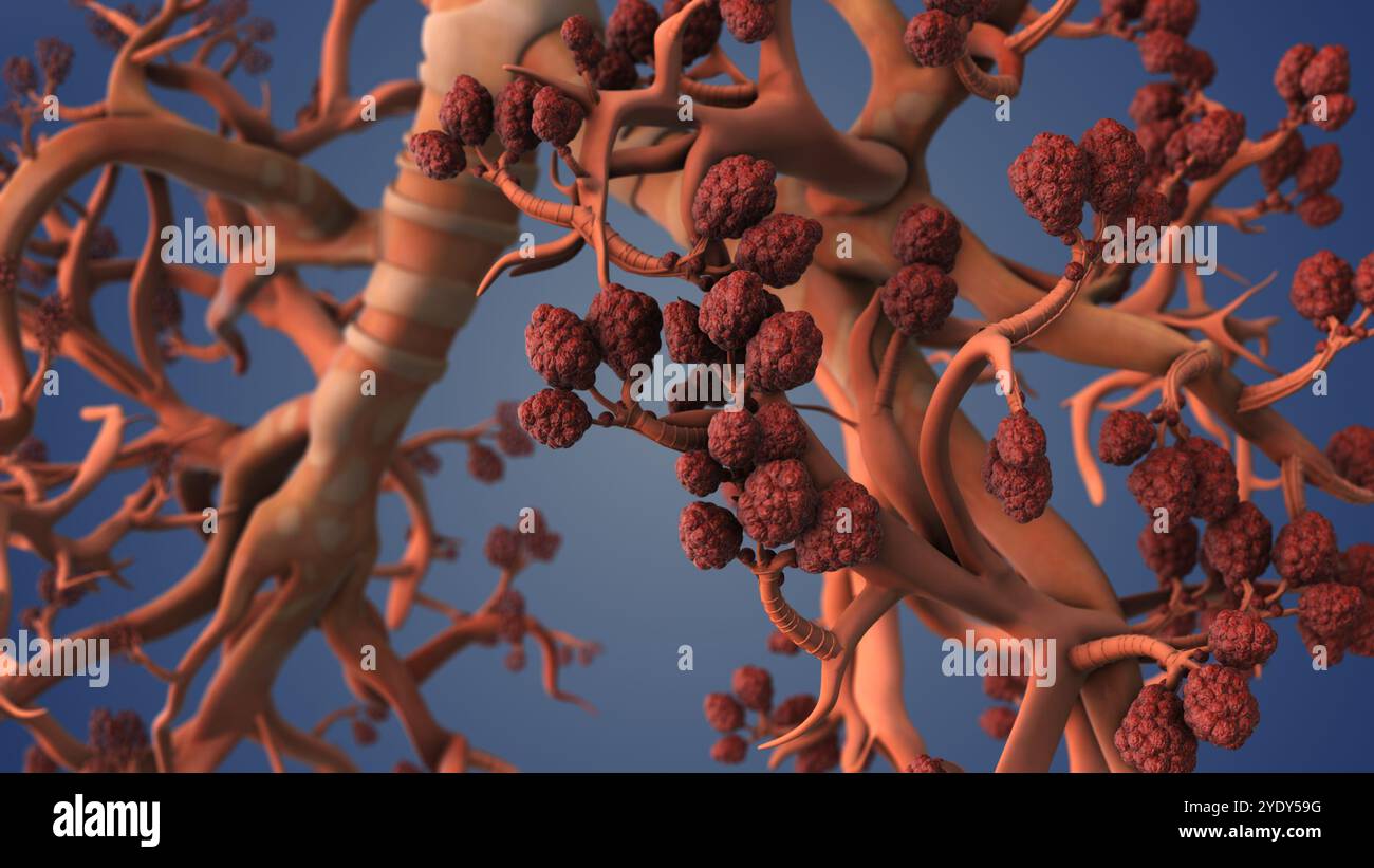 Breathing Alveoli Within Structure of Human Lungs Stock Photo