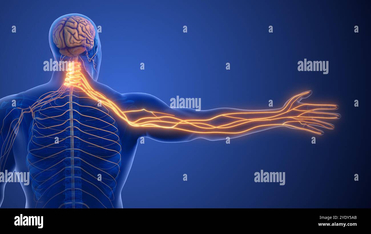 Cervical Spine Nerve Compression Causing Radiculopathy Stock Photo