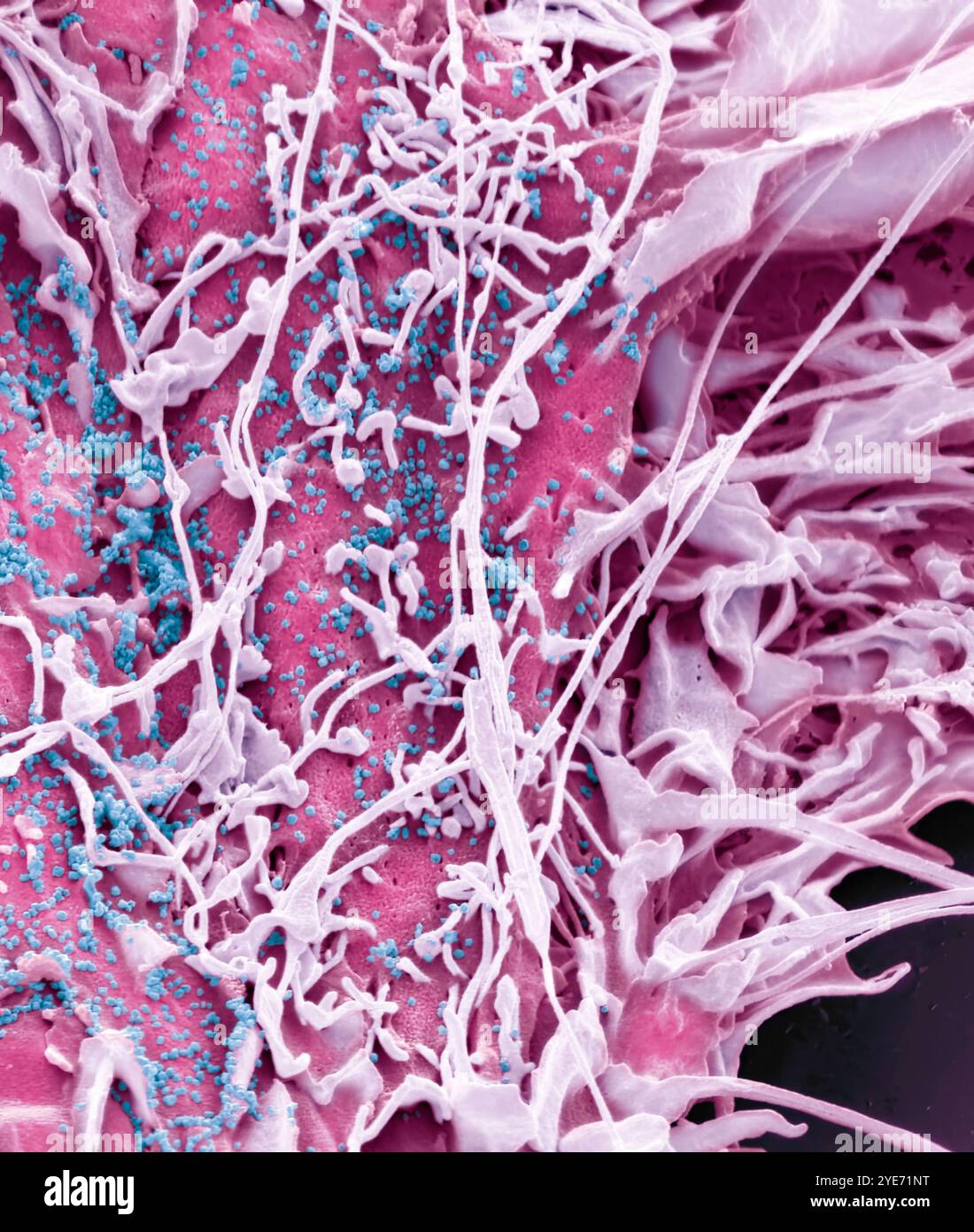 MERS. Coloured scanning electron micrograph (SEM). Viral particles ...