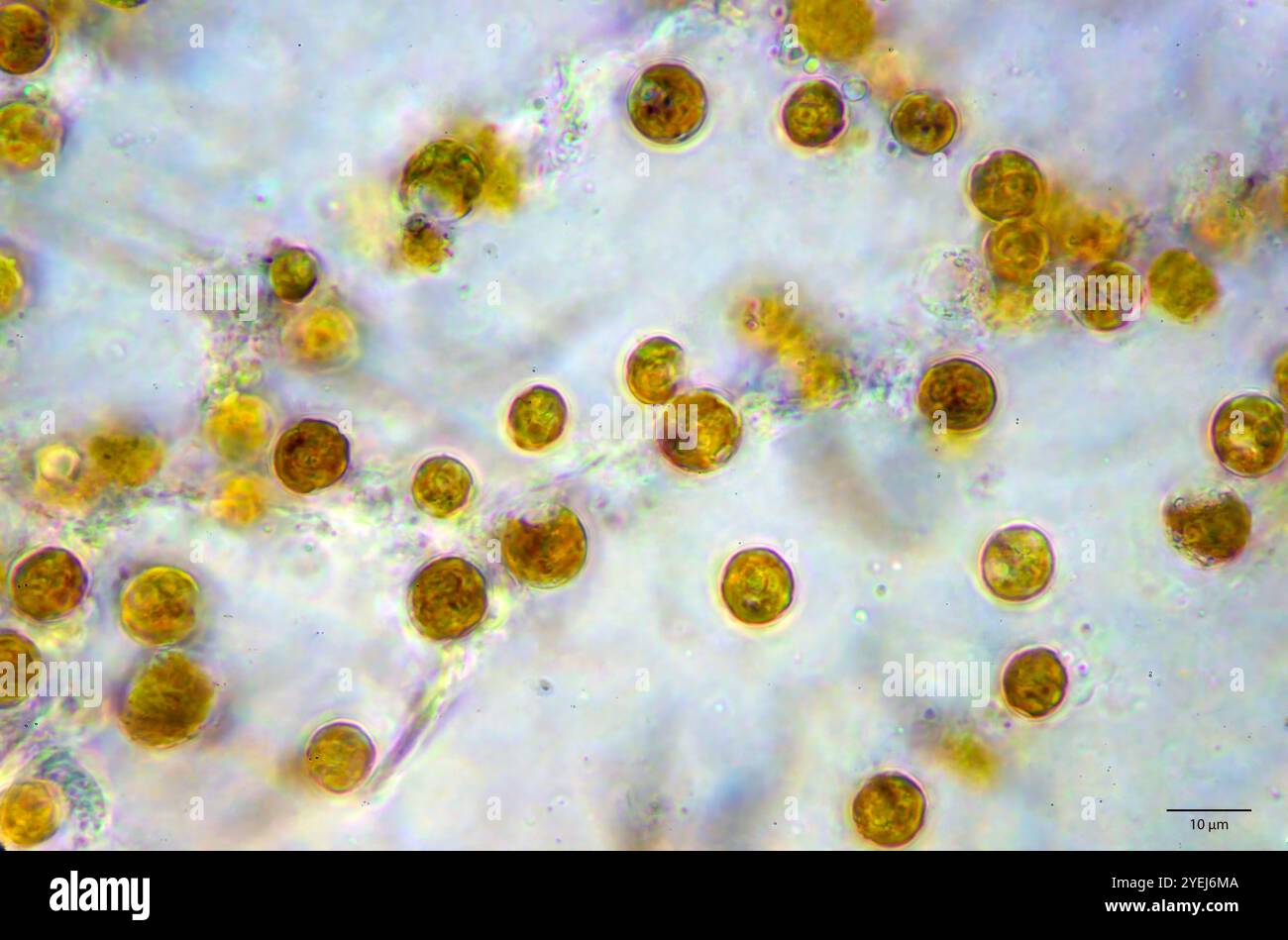 Symbiotic algae (zooxanthellae) from Aiptasia sp., probably belonging to the speceis Breviolum dendrogyrum. Stock Photo