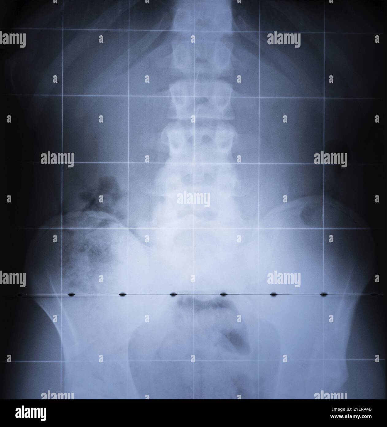 X Ray image of Spine and pelvis of human body Stock Photo - Alamy
