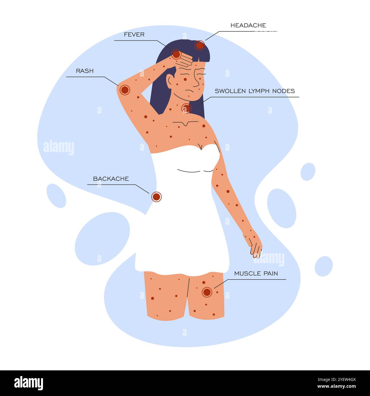 African skin rash hi-res stock photography and images - Alamy