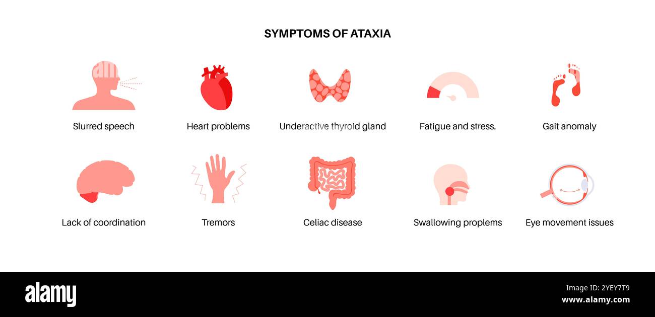 Conceptual illustration of cerebellar ataxia. Ataxia is disorder that ...