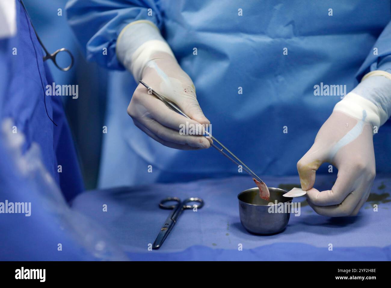 Cardiology Hospital. Operating theater. Cardiac surgery. Surgical ...