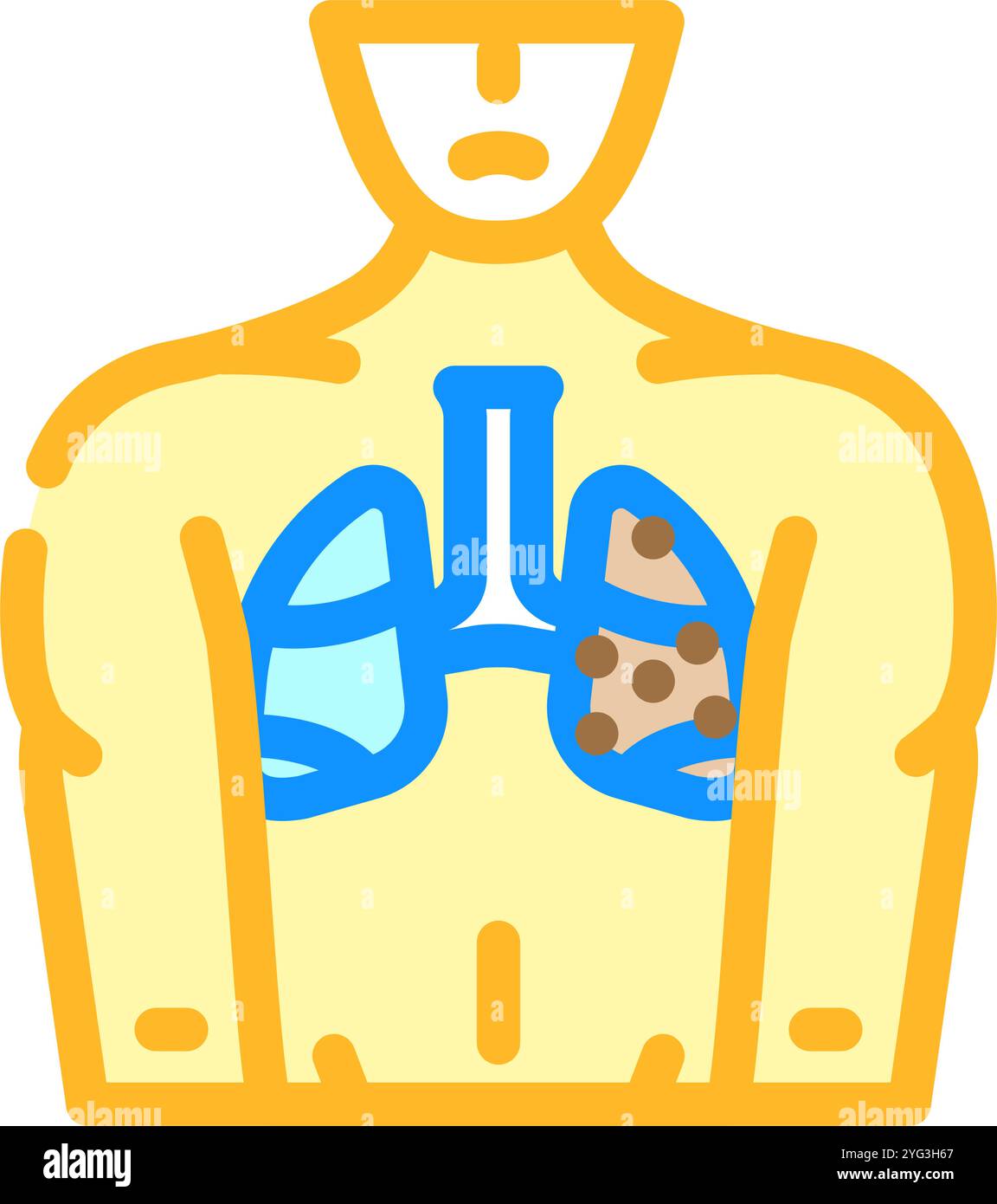 chronic obstructive pulmonary disease color icon vector illustration ...