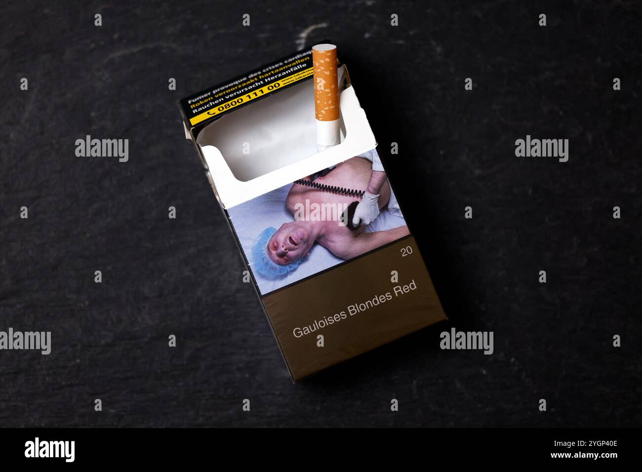 what diseases does cigarette smoking cause Smoking: The Top Cause of Avoidable Death what diseases does cigarette smoking cause Smoking: The Top Cause of Avoidable Death