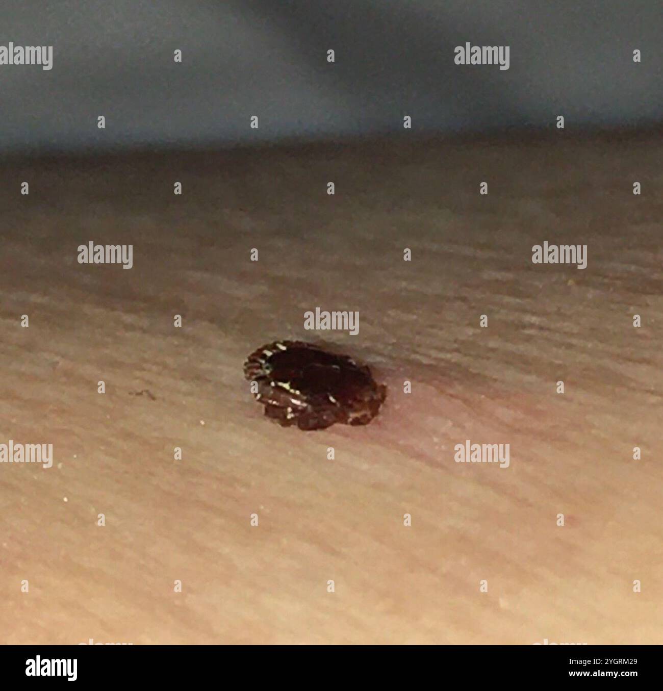 Lone Star Tick (Amblyomma americanum) Stock Photo