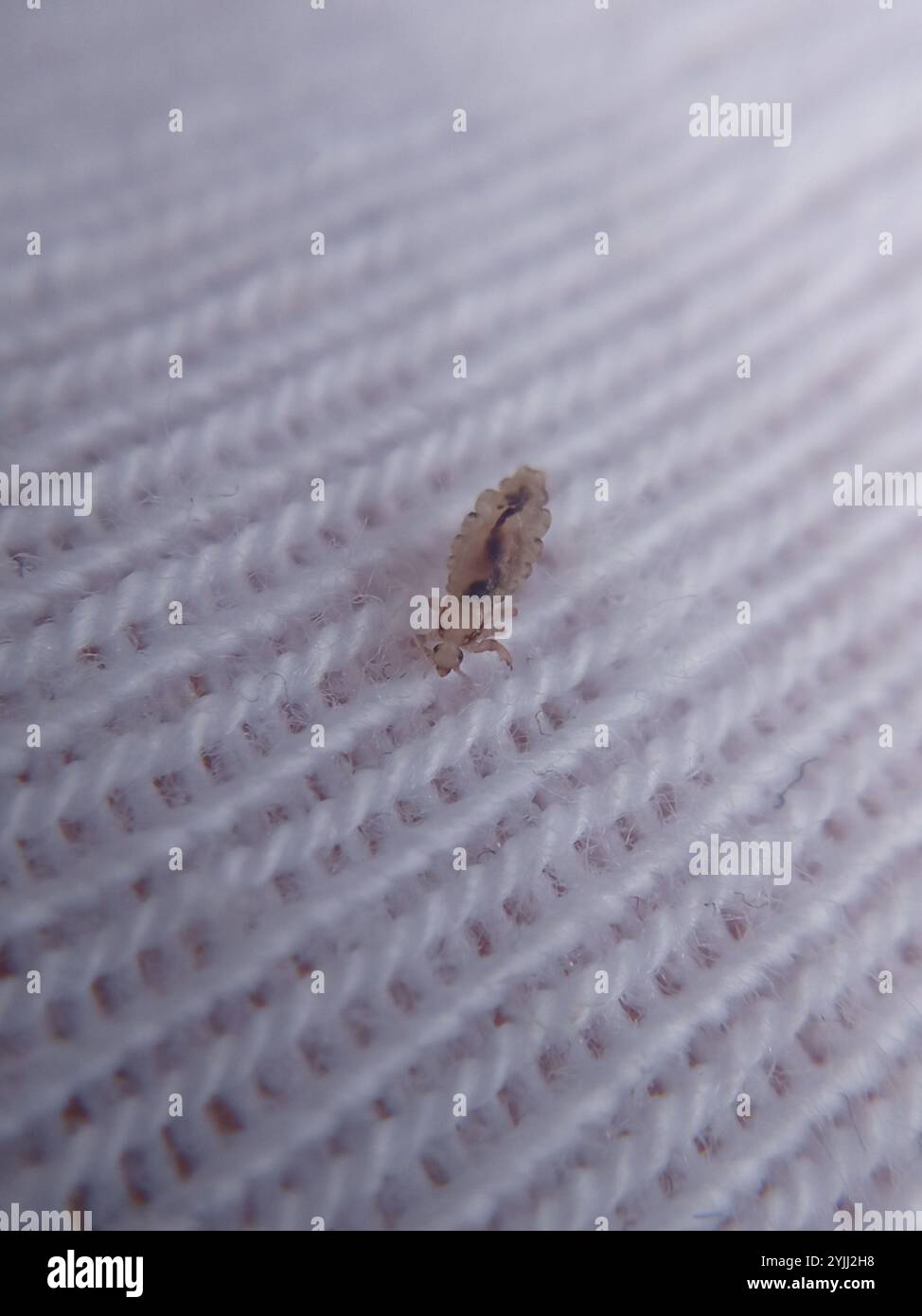 Human Louse (Pediculus humanus Stock Photo - Alamy