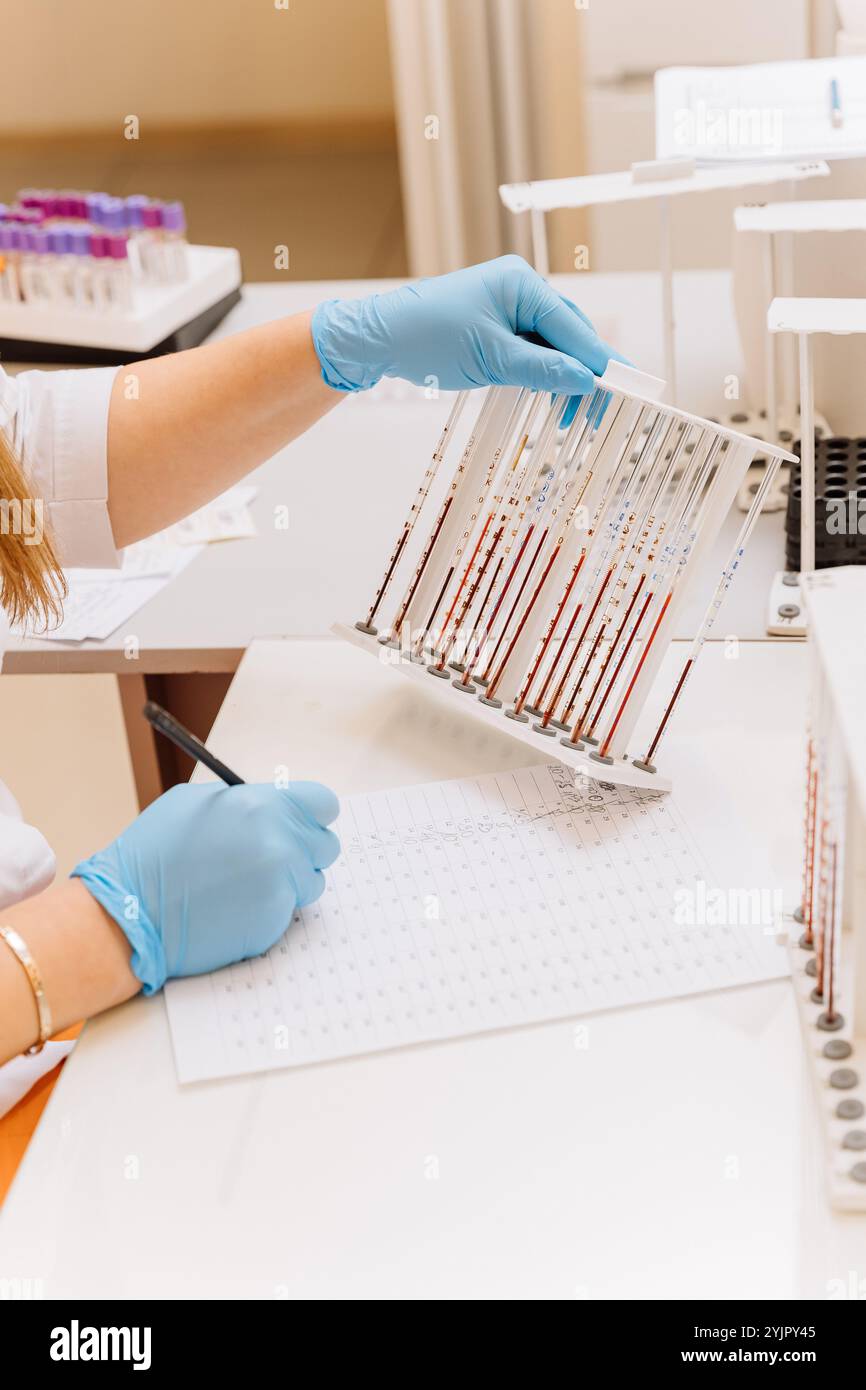 Labanalysis hi-res stock photography and images - Alamy
