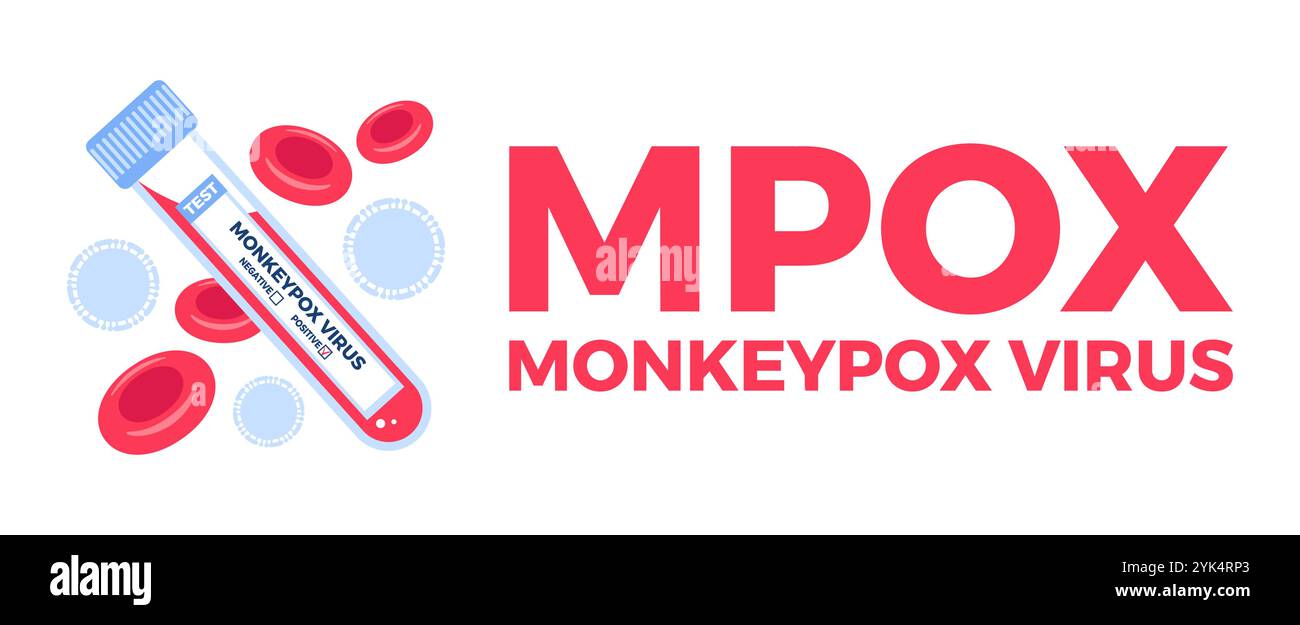 Laboratory tube containing a blood sample of the monkeypox virus for ...