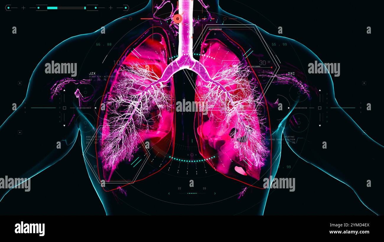 copd lung disease, chronic obstructive pulmonary disorder concept 3d rendering Stock Photo