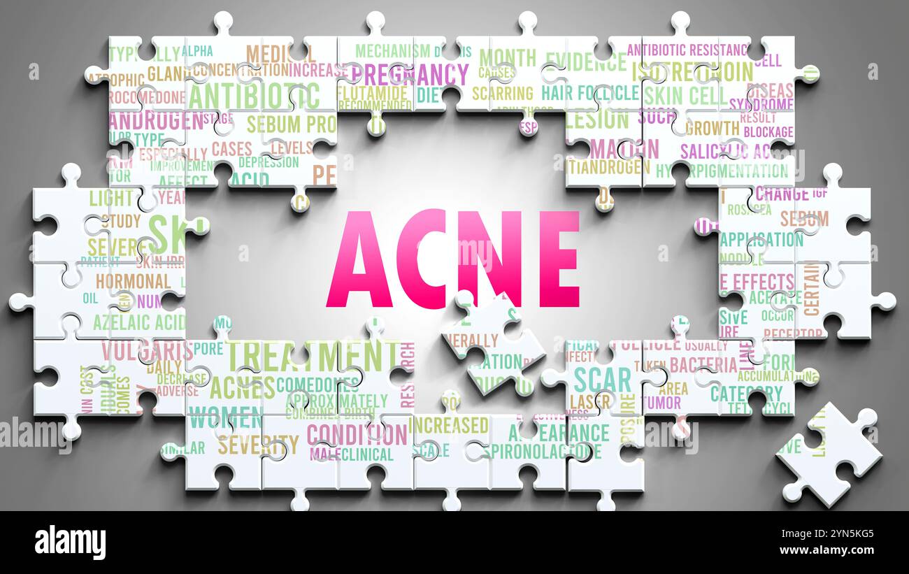 Acne being a complex subject, related to other important topics. Stock Photo