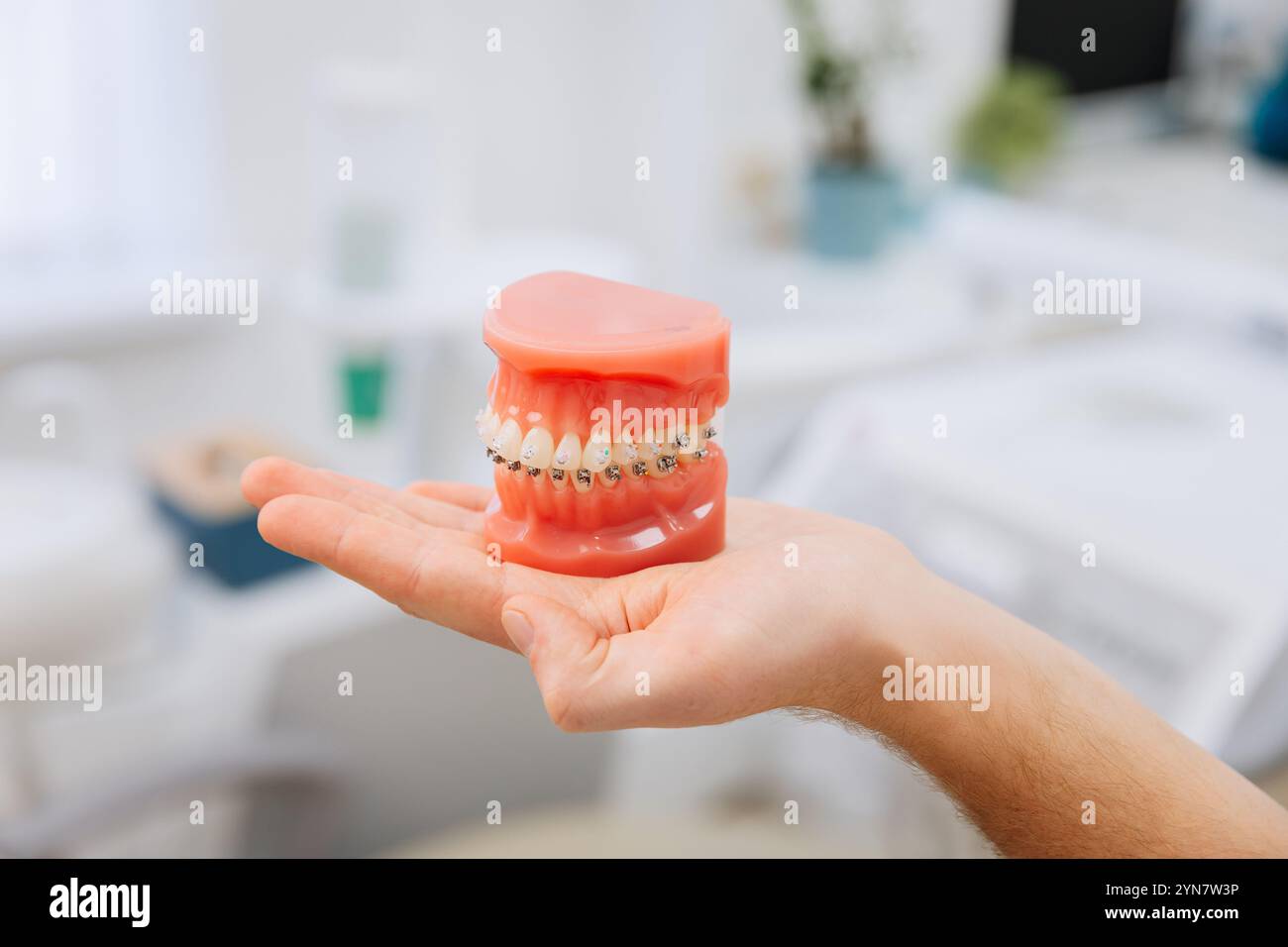 Hand holding orthodontic model with braces, showcasing dental care and orthodontic treatment Stock Photo