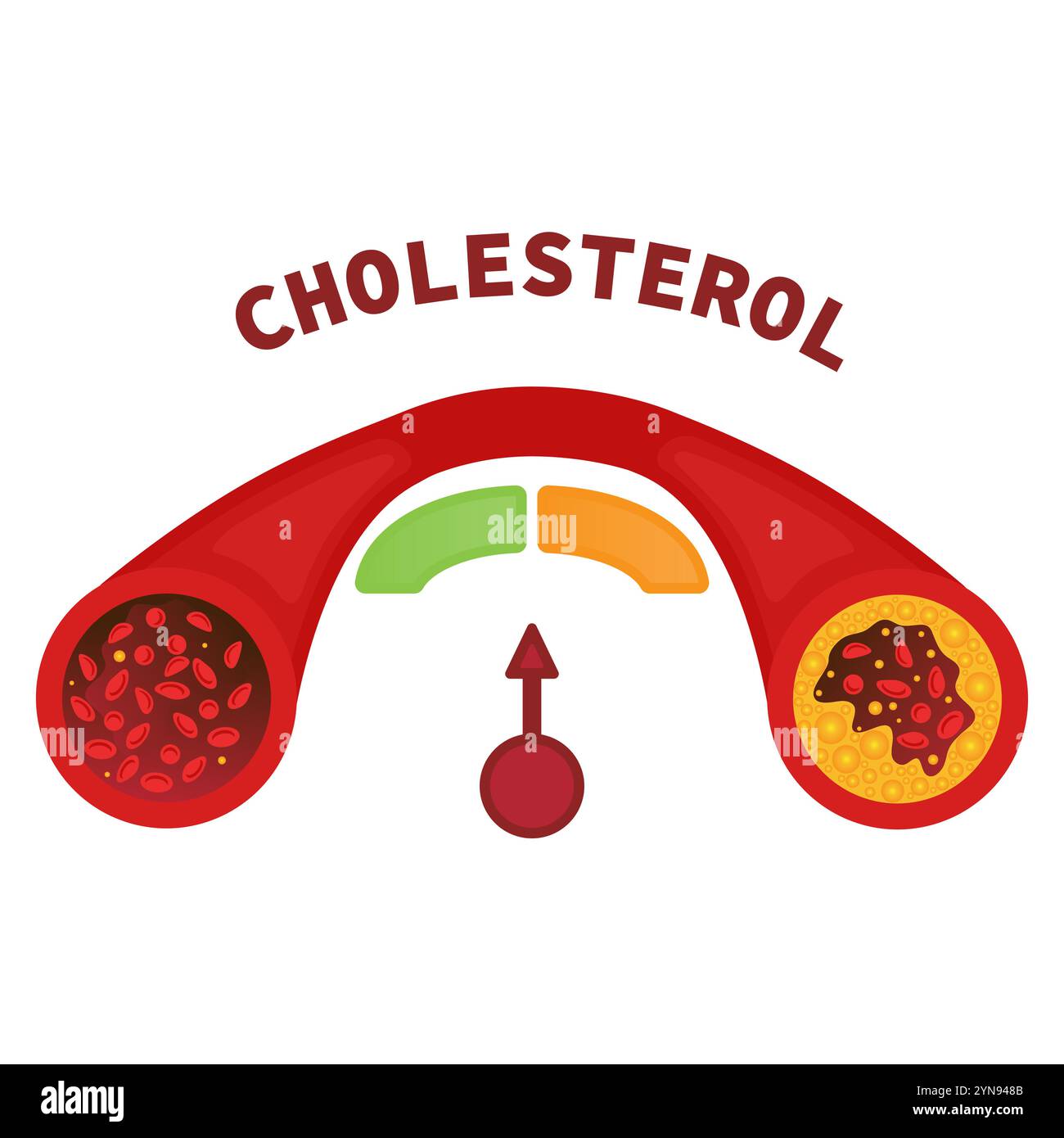 Ldl test Stock Vector Images - Alamy, image size:1300x1390