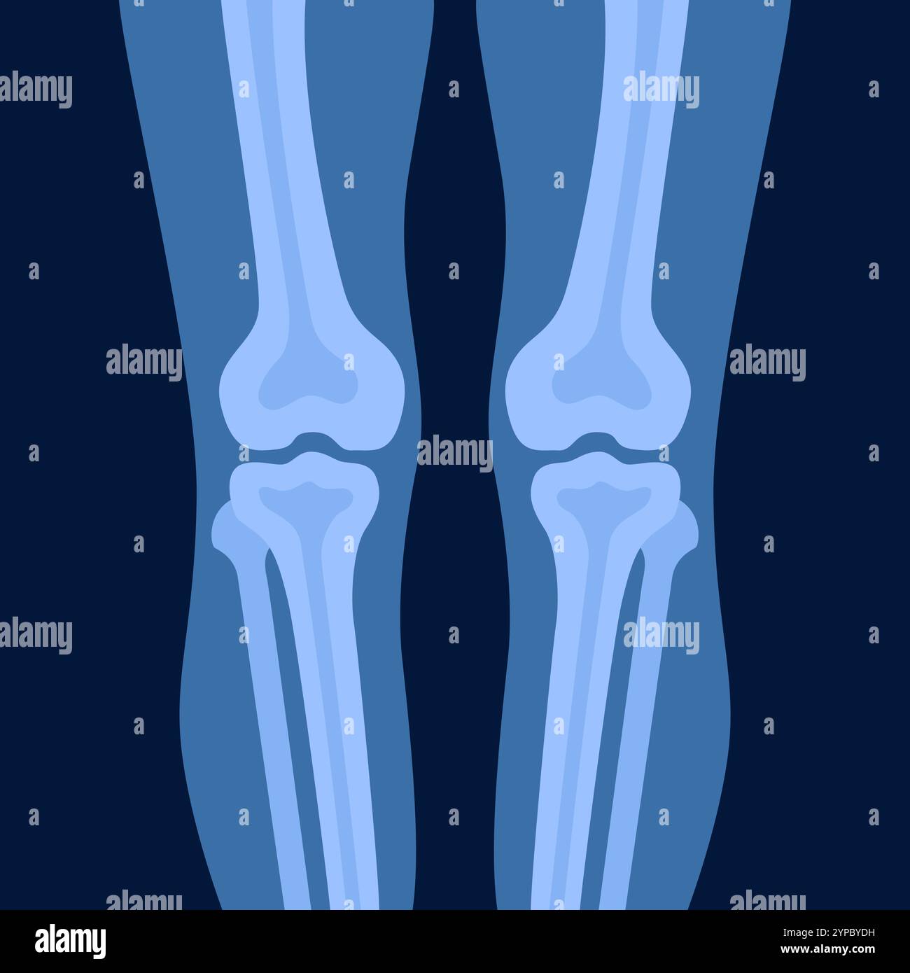 Xray of human knees bones and joints, examination and diagnosis ...
