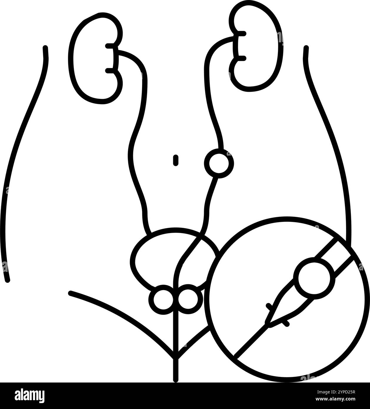 ureteroscopy urology line icon vector illustration Stock Vector Image ...