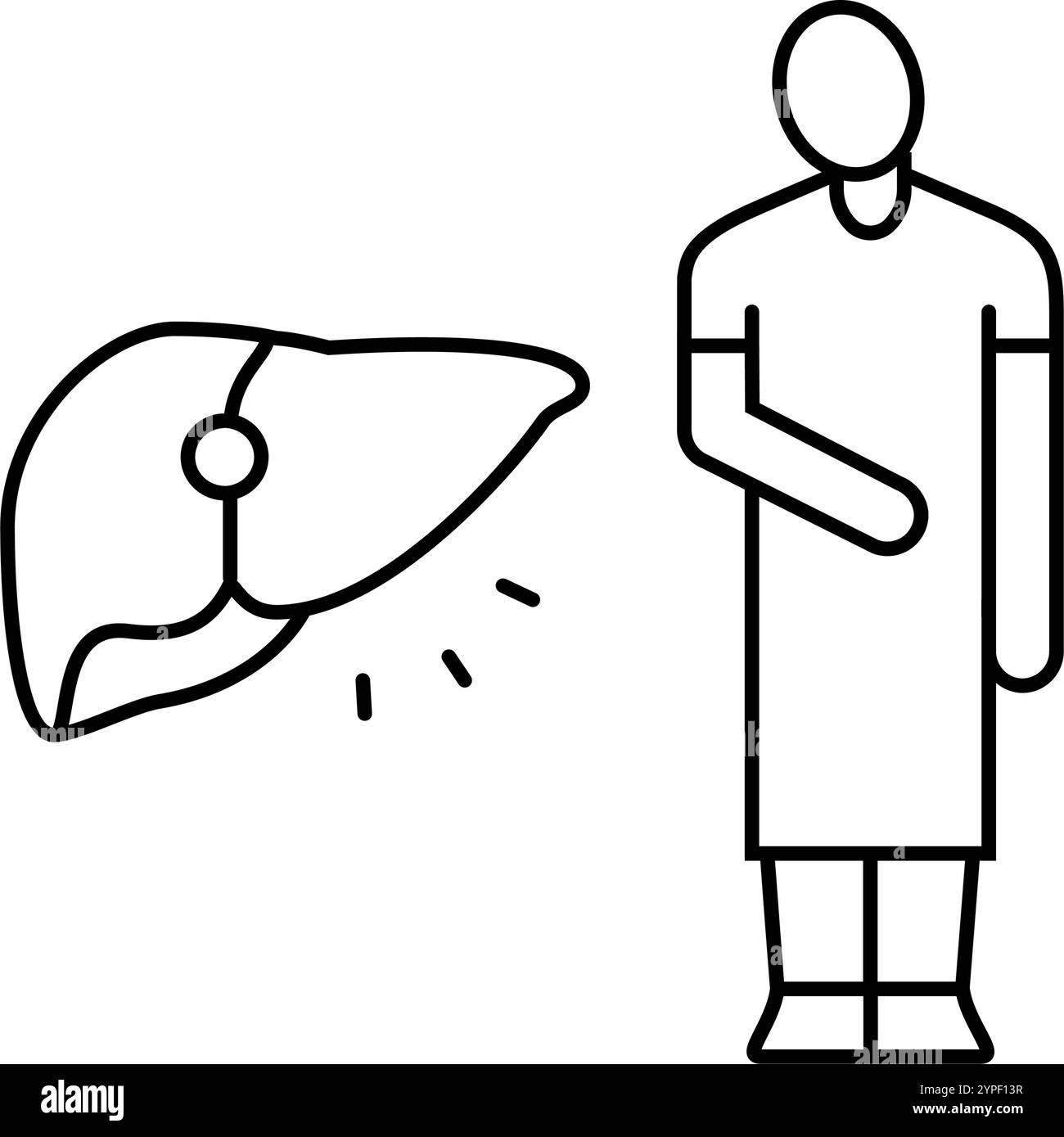 Liver disease patient Black and White Stock Photos & Images - Alamy