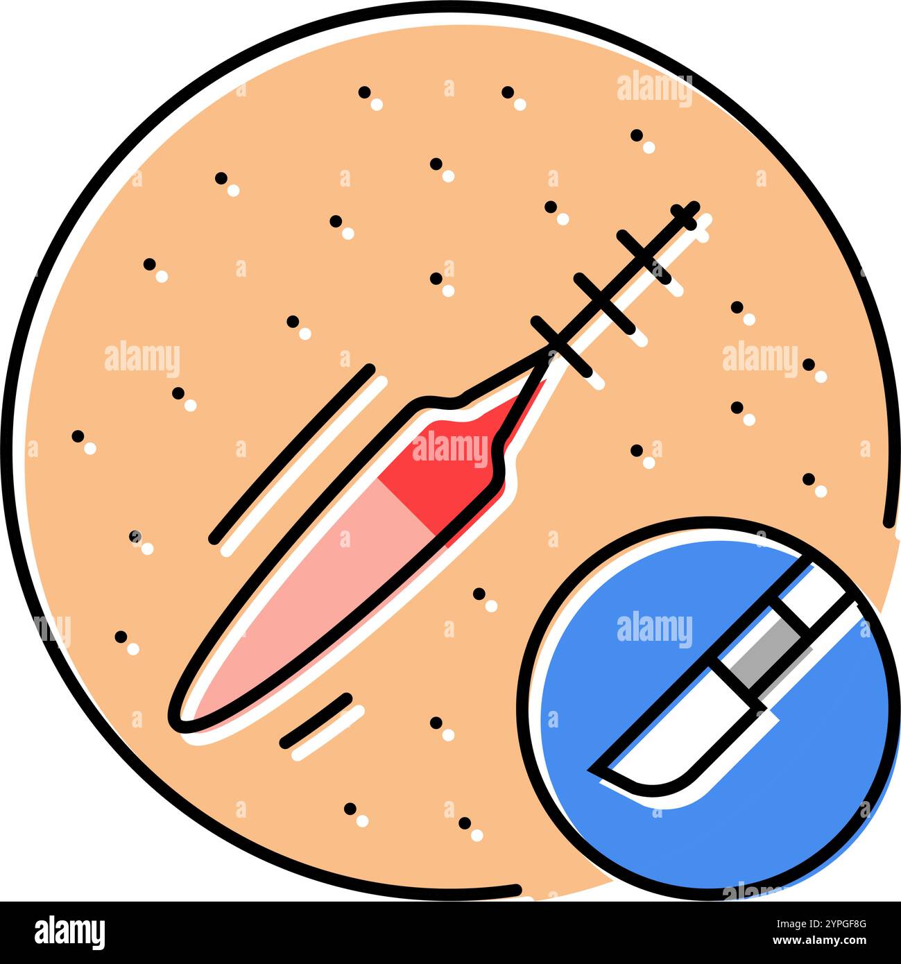 Hysterectomy procedure Stock Vector Images - Alamy