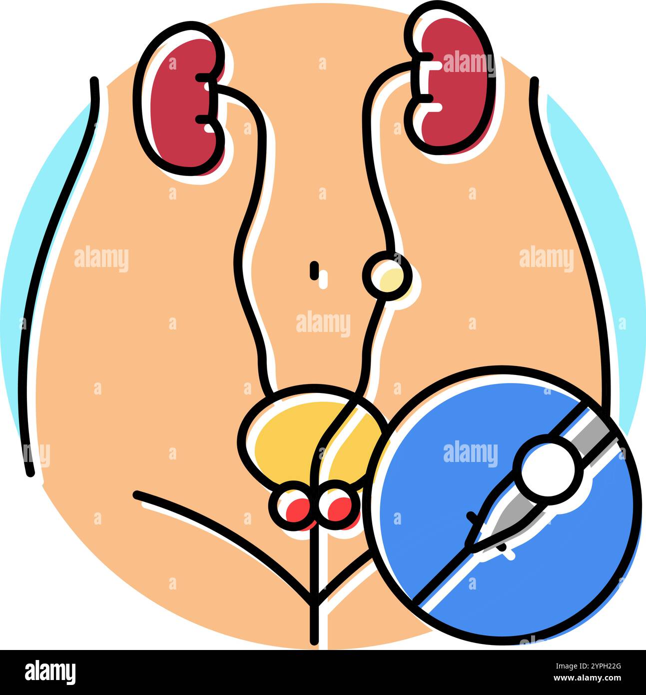 ureteroscopy urology color icon vector illustration Stock Vector Image ...