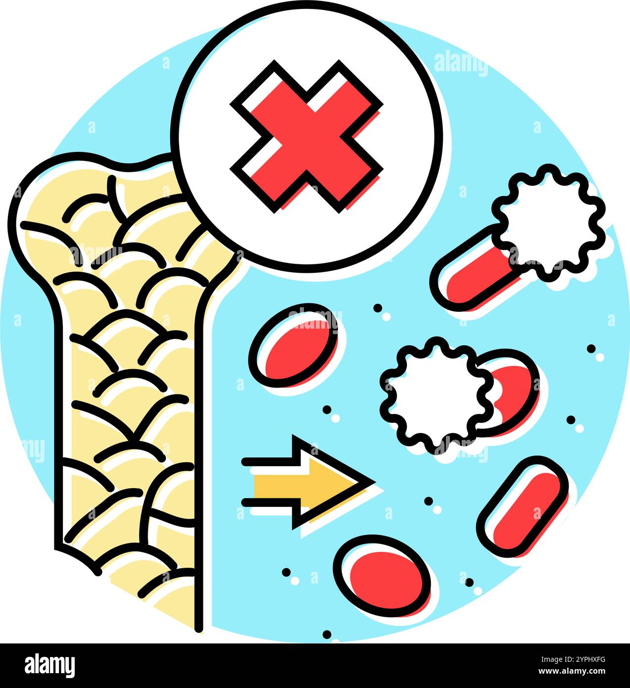 myelofibrosis disease color icon vector illustration Stock Vector Image ...