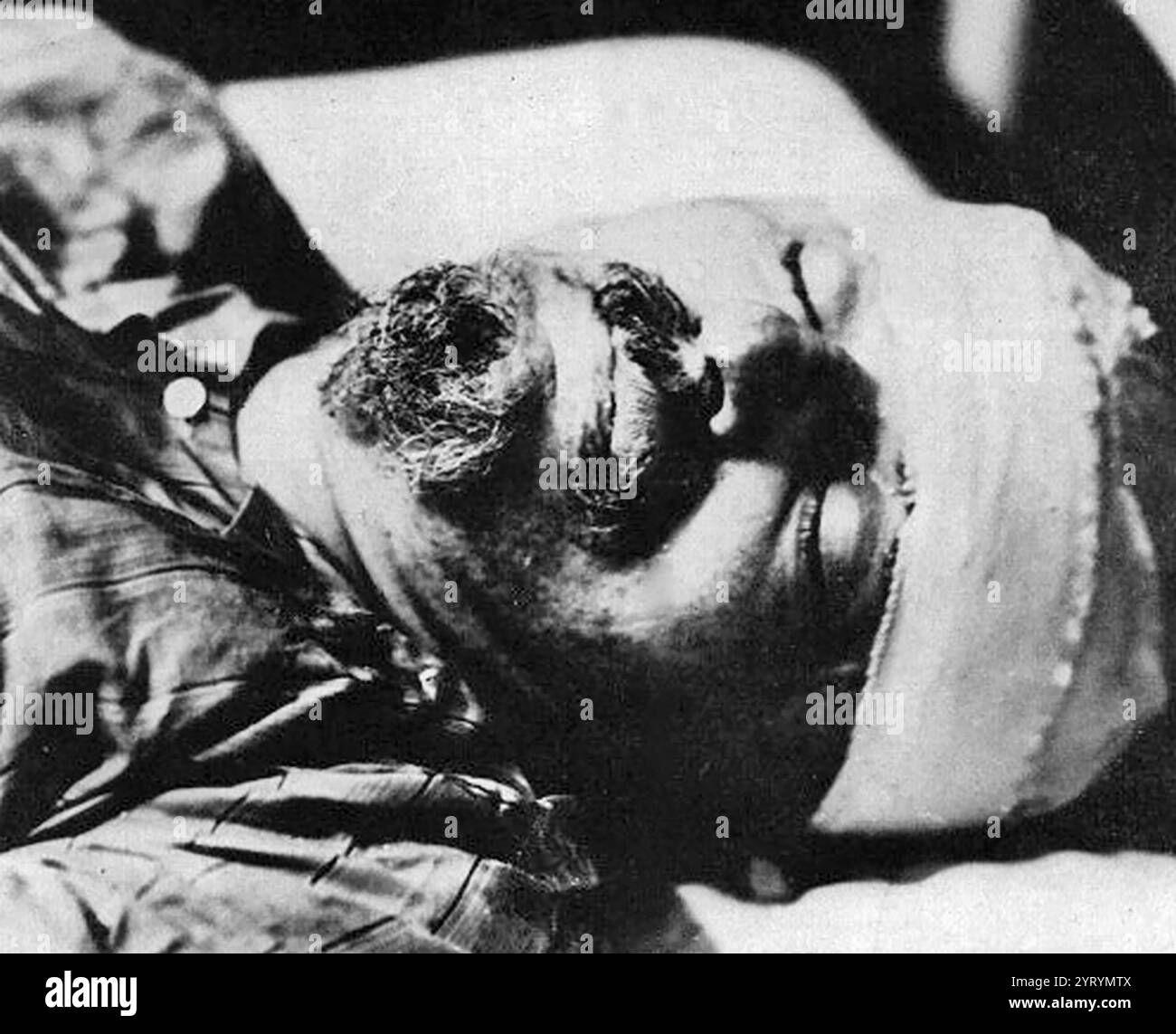 Leon Trotsky dead in Hospital shortly after his assassination Stock Photo