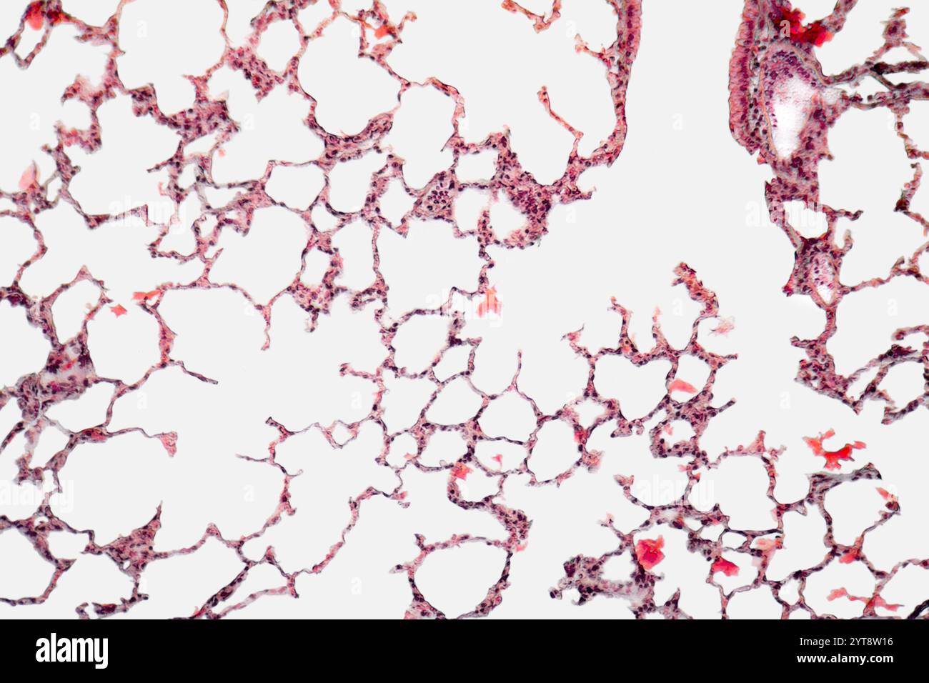 Microscopic detail showing a section of the lung tissue from a rabbit ...