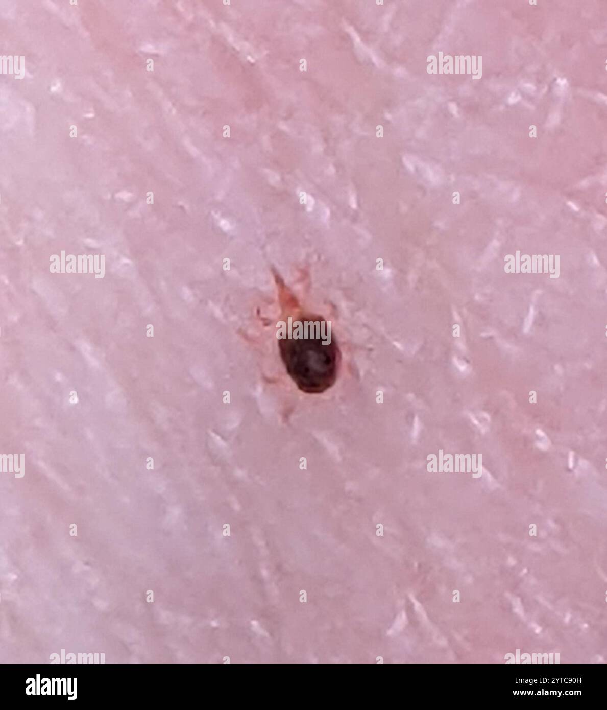 Mites and Ticks (Acari Stock Photo - Alamy